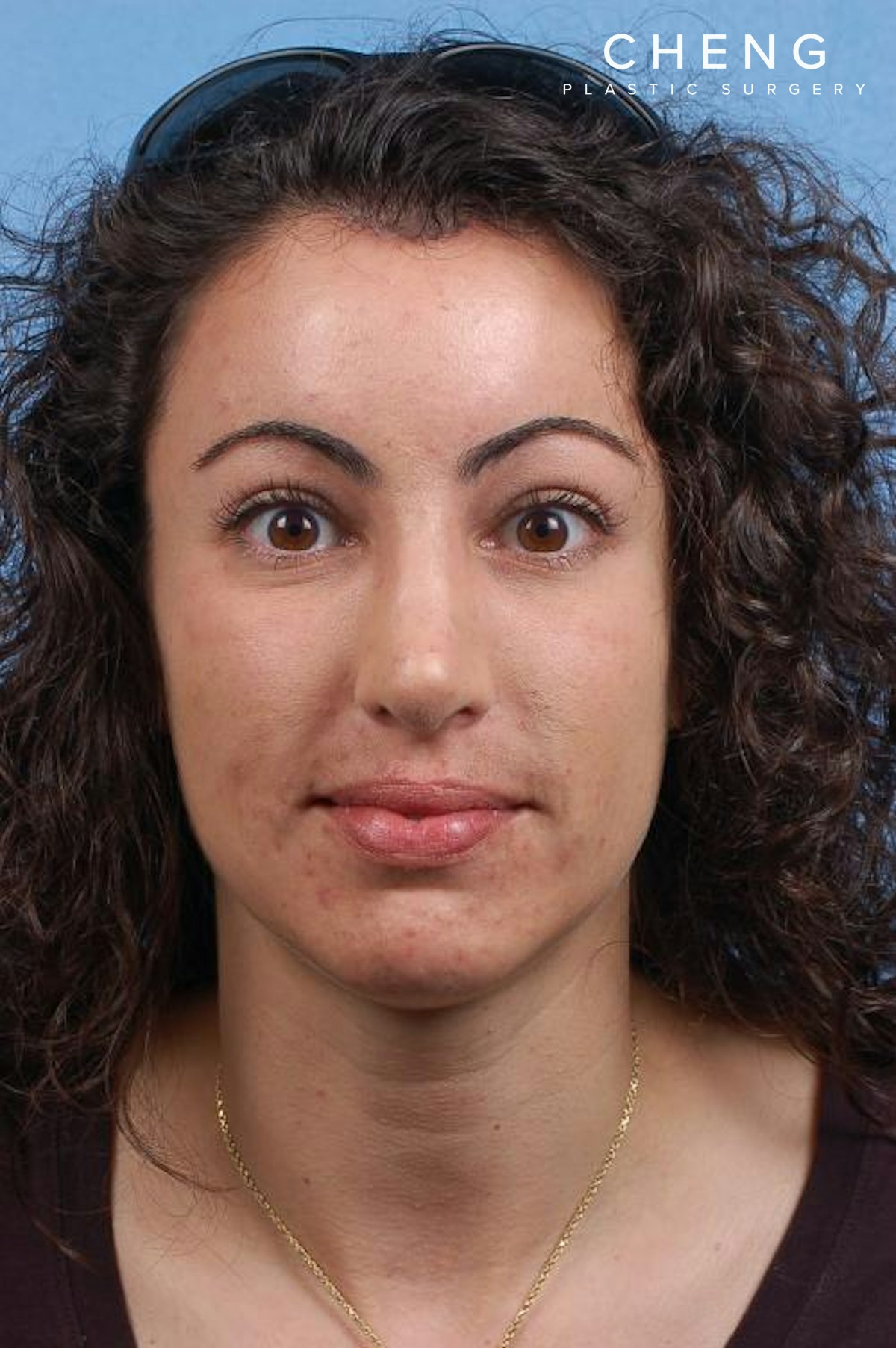 Hidden Patients Before & After Gallery - Patient 189141 - Image 2