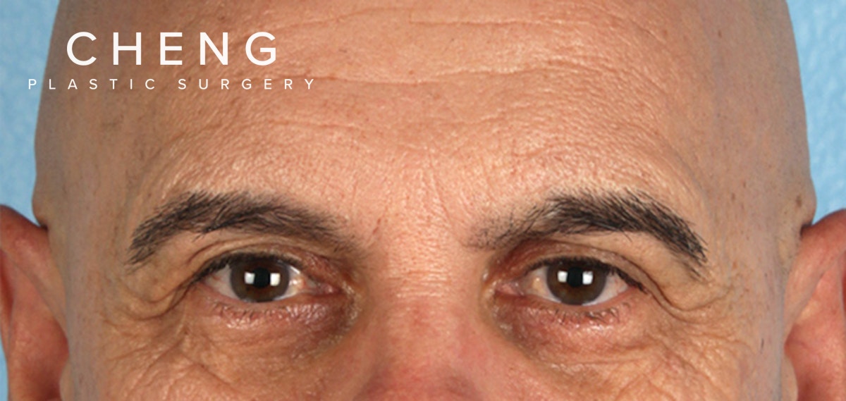 Hidden Patients Before & After Gallery - Patient 421996 - Image 1