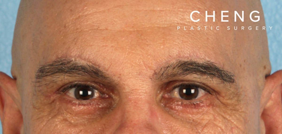 Hidden Patients Before & After Gallery - Patient 421996 - Image 2