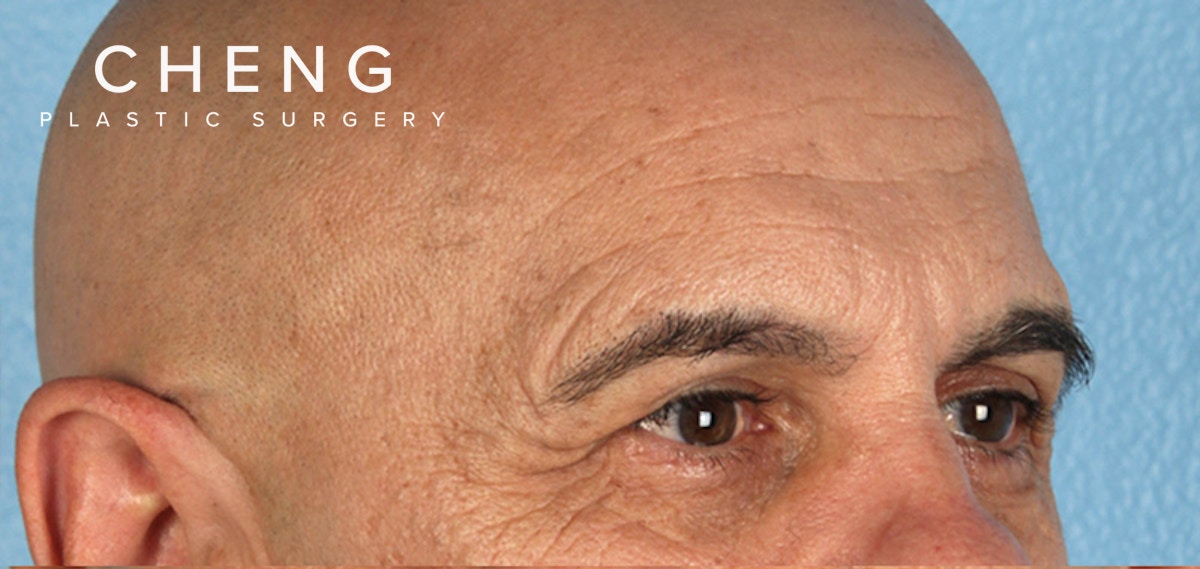 Hidden Patients Before & After Gallery - Patient 421996 - Image 3