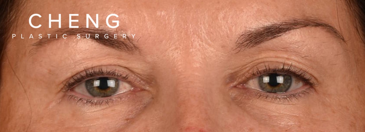 Hidden Patients Before & After Gallery - Patient 262469 - Image 1