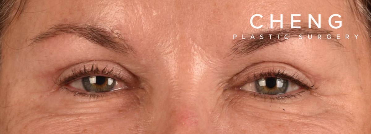 Hidden Patients Before & After Gallery - Patient 262469 - Image 2