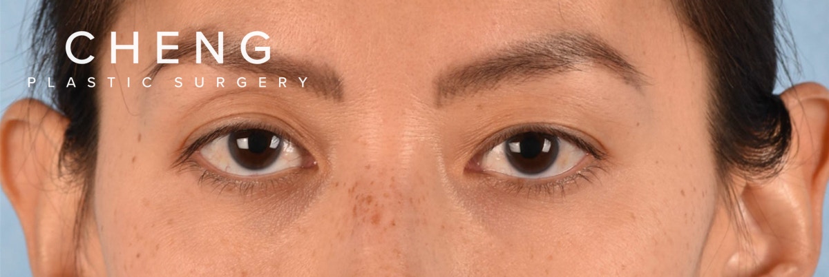Hidden Patients Before & After Gallery - Patient 295978 - Image 1