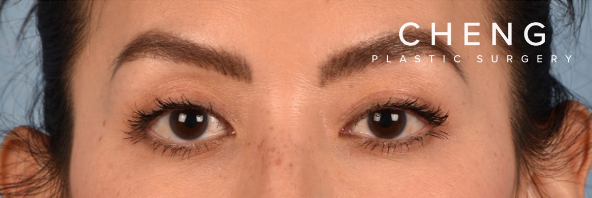 Hidden Patients Before & After Gallery - Patient 295978 - Image 2