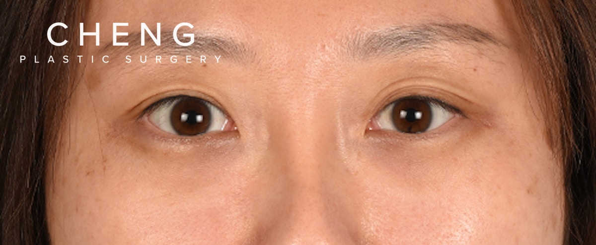 Hidden Patients Before & After Gallery - Patient 300838 - Image 1