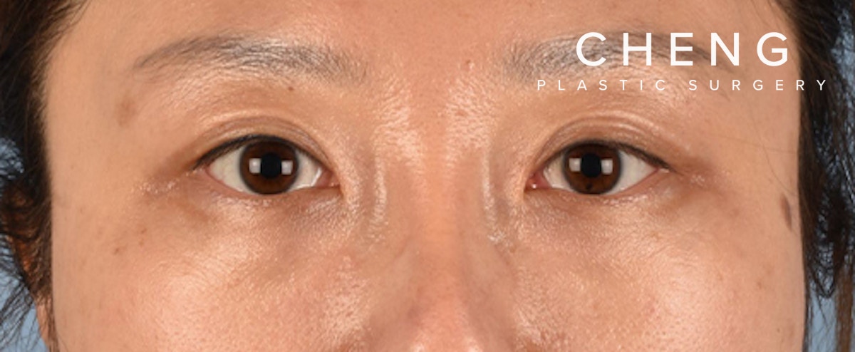 Hidden Patients Before & After Gallery - Patient 300838 - Image 2