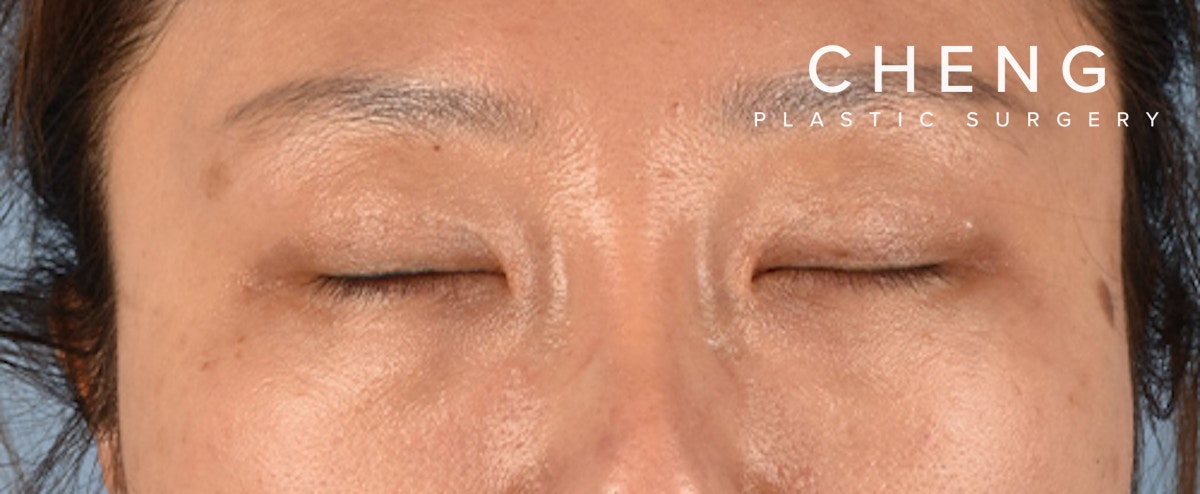Hidden Patients Before & After Gallery - Patient 300838 - Image 4