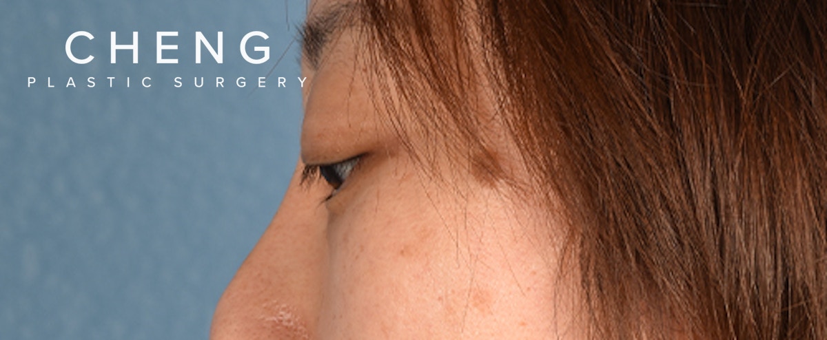 Hidden Patients Before & After Gallery - Patient 300838 - Image 7
