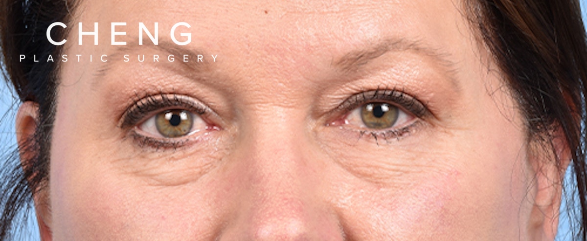 Hidden Patients Before & After Gallery - Patient 140219 - Image 1