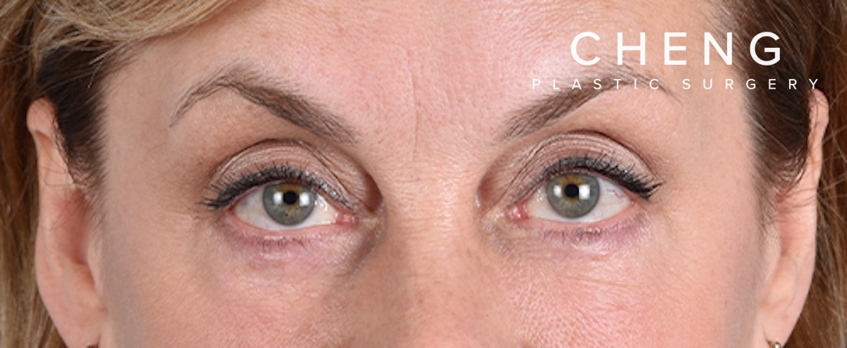 Hidden Patients Before & After Gallery - Patient 561726 - Image 2