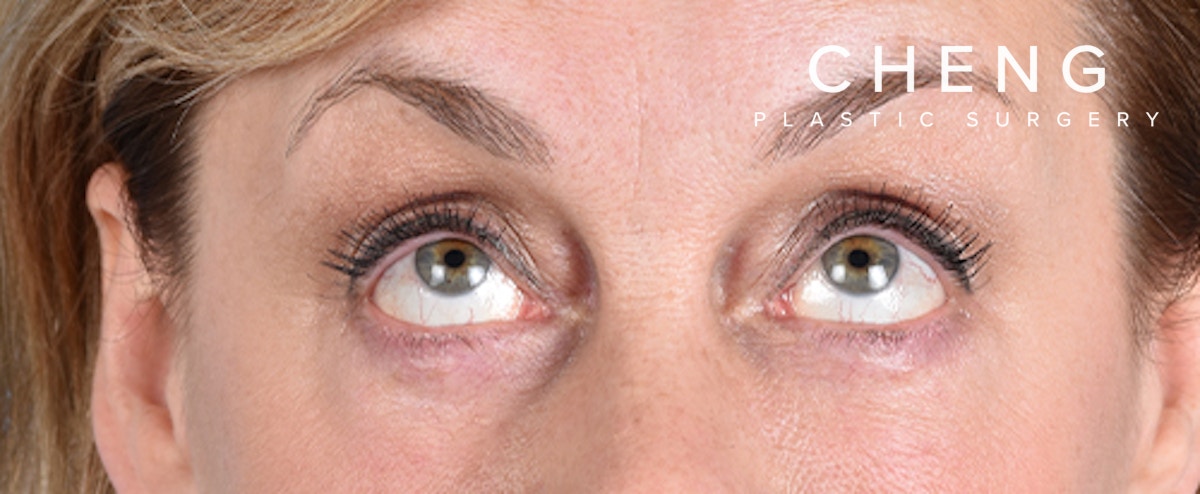 Hidden Patients Before & After Gallery - Patient 561726 - Image 4