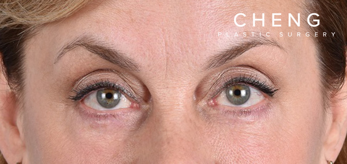 Hidden Patients Before & After Gallery - Patient 132269 - Image 2