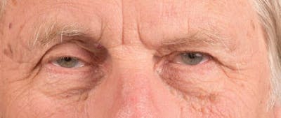 Hidden Patients Before & After Gallery - Patient 146304 - Image 1