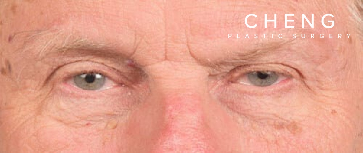Hidden Patients Before & After Gallery - Patient 146304 - Image 2