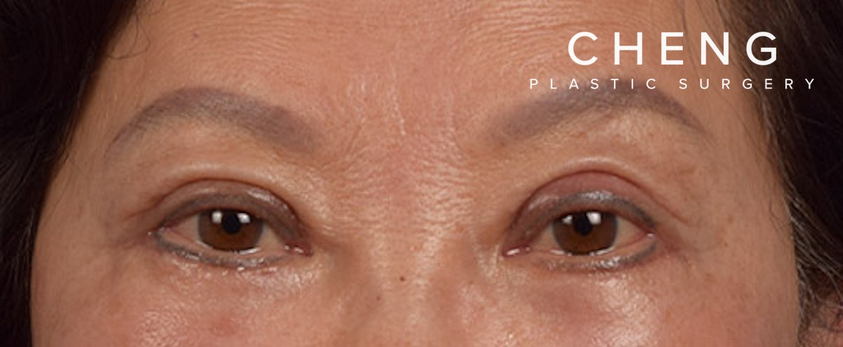 Hidden Patients Before & After Gallery - Patient 145659 - Image 2