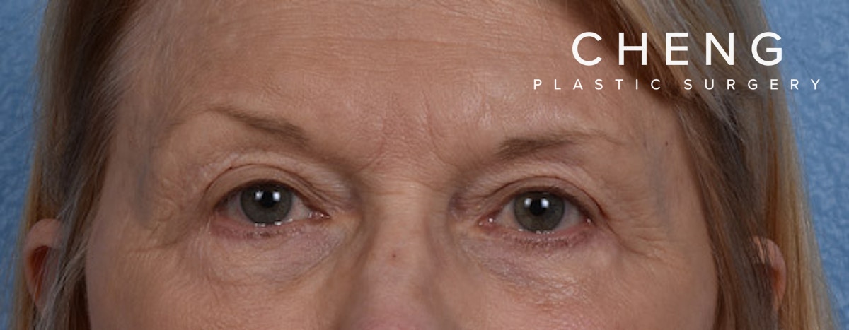 Hidden Patients Before & After Gallery - Patient 288598 - Image 2