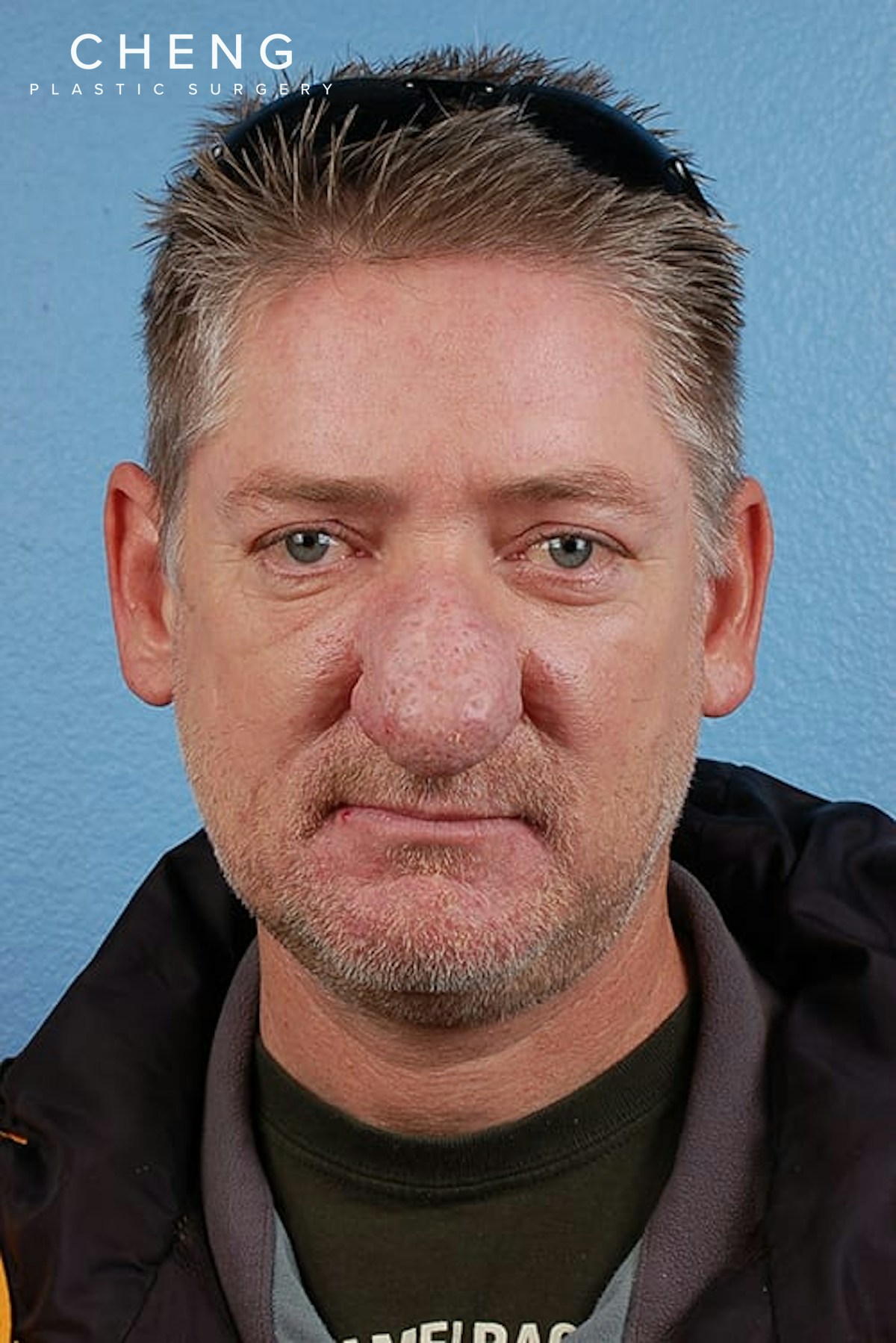 Hidden Patients Before & After Gallery - Patient 532992 - Image 1