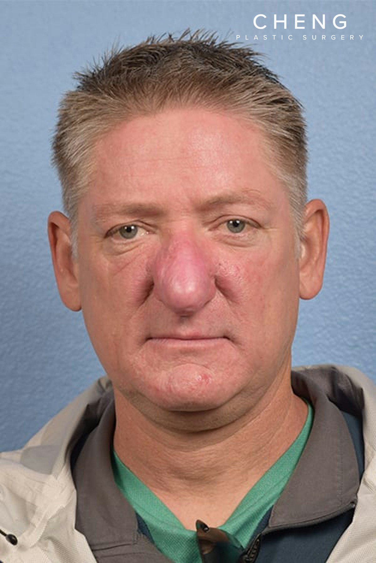 Hidden Patients Before & After Gallery - Patient 532992 - Image 2