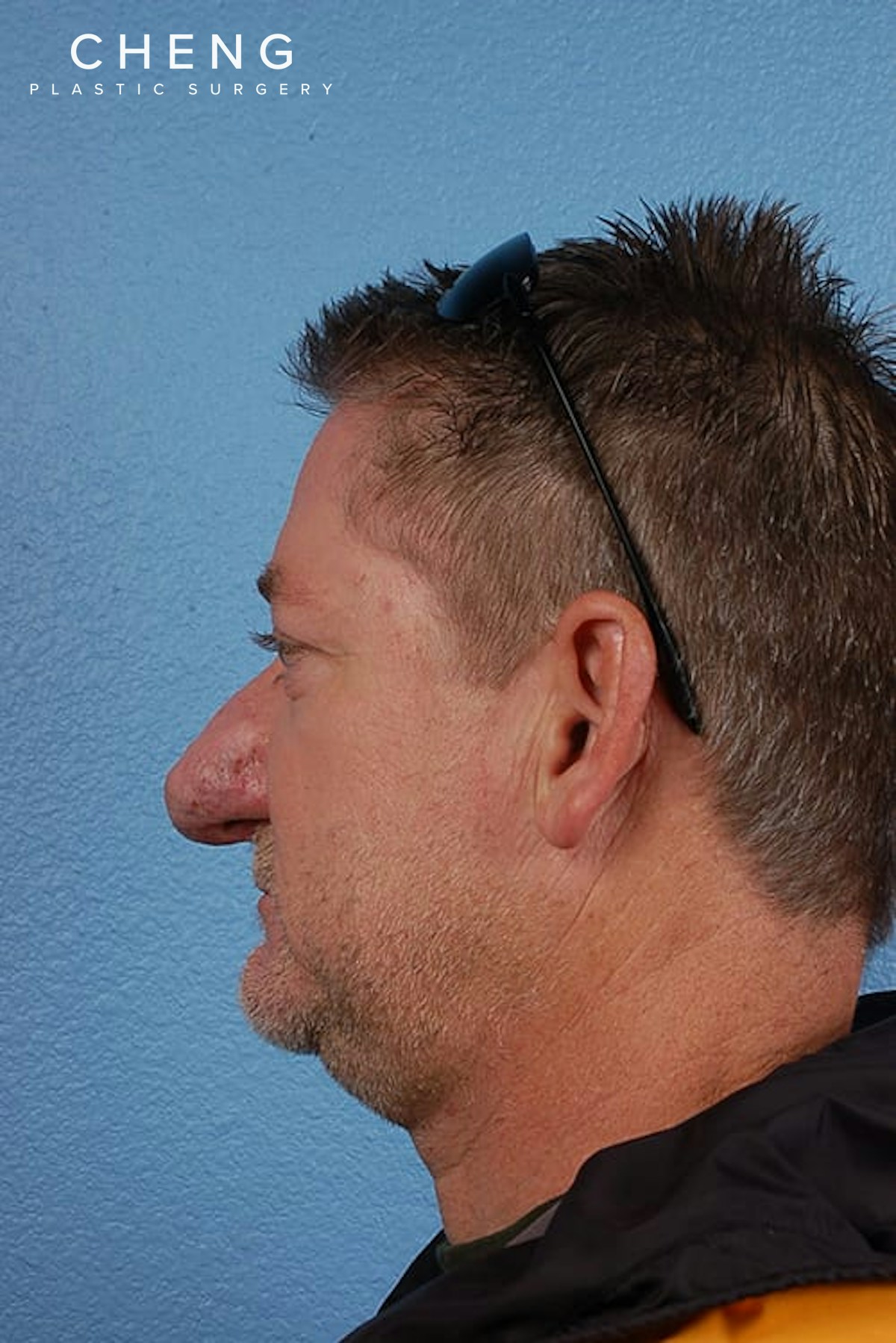 Hidden Patients Before & After Gallery - Patient 532992 - Image 5