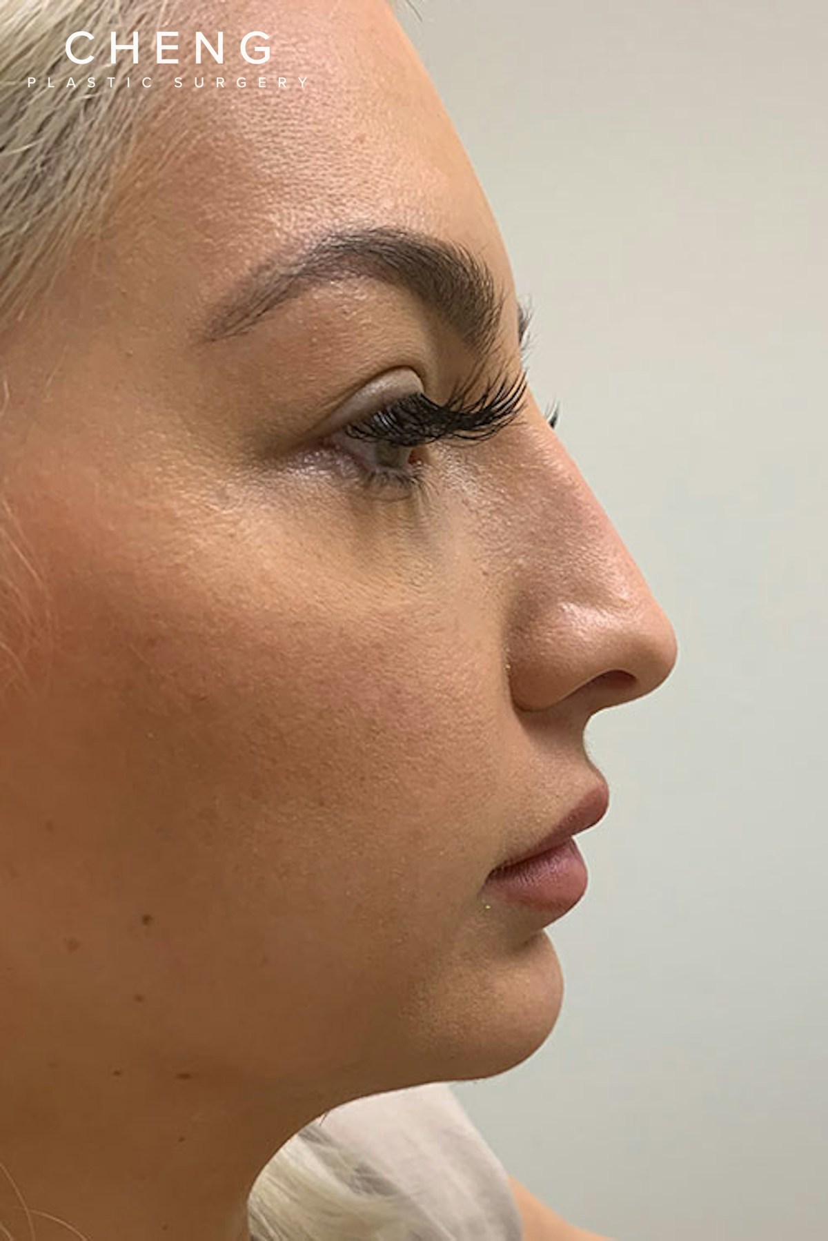 Hidden Patients Before & After Gallery - Patient 324981 - Image 1