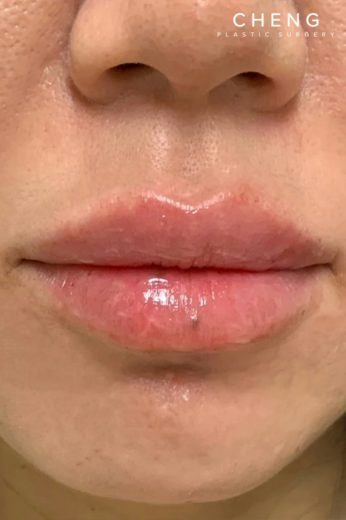 Hidden Patients Before & After Gallery - Patient 188403 - Image 2