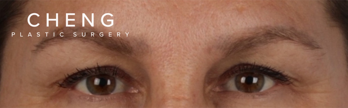 Hidden Patients Before & After Gallery - Patient 283134 - Image 1