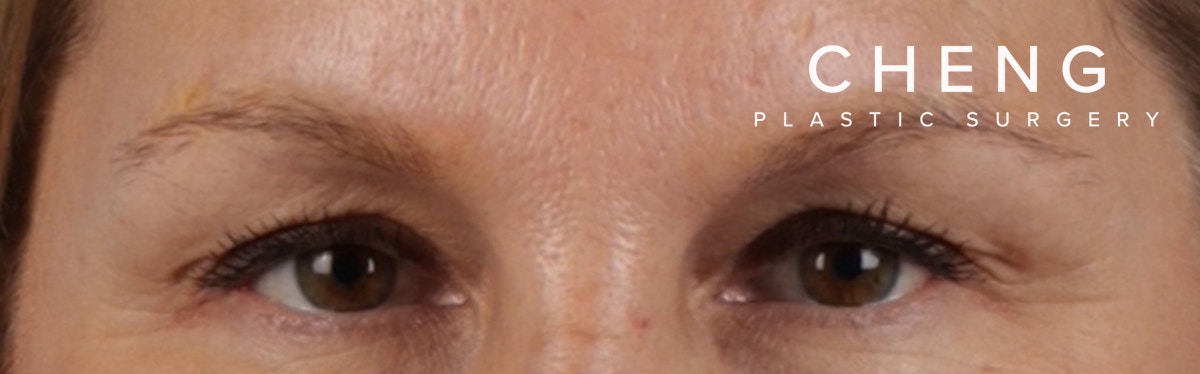 Hidden Patients Before & After Gallery - Patient 283134 - Image 2