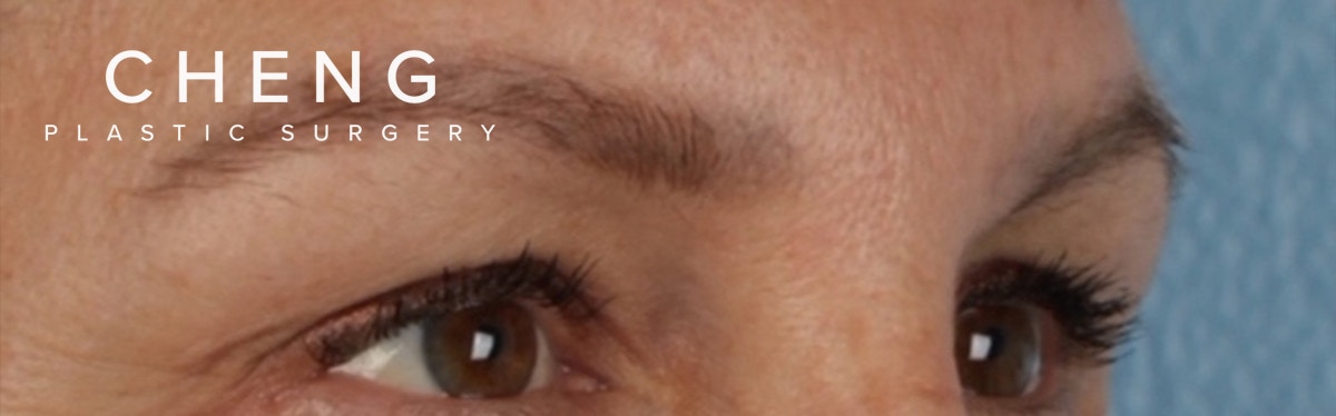 Hidden Patients Before & After Gallery - Patient 283134 - Image 3