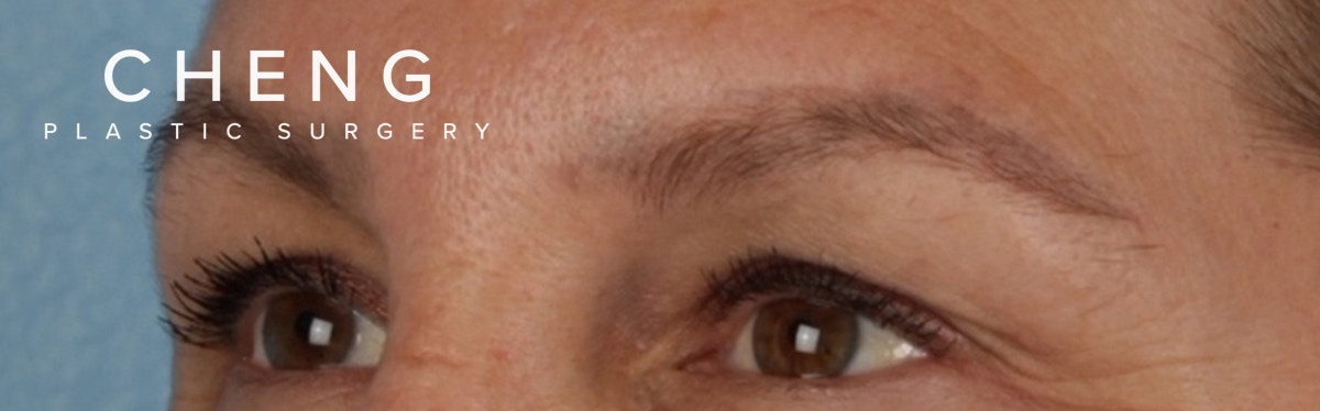 Hidden Patients Before & After Gallery - Patient 283134 - Image 5
