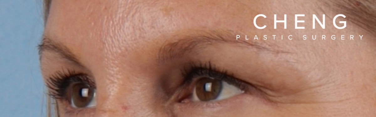 Hidden Patients Before & After Gallery - Patient 283134 - Image 6