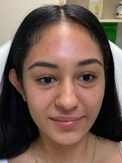 Hidden Patients Before & After Gallery - Patient 105891 - Image 1