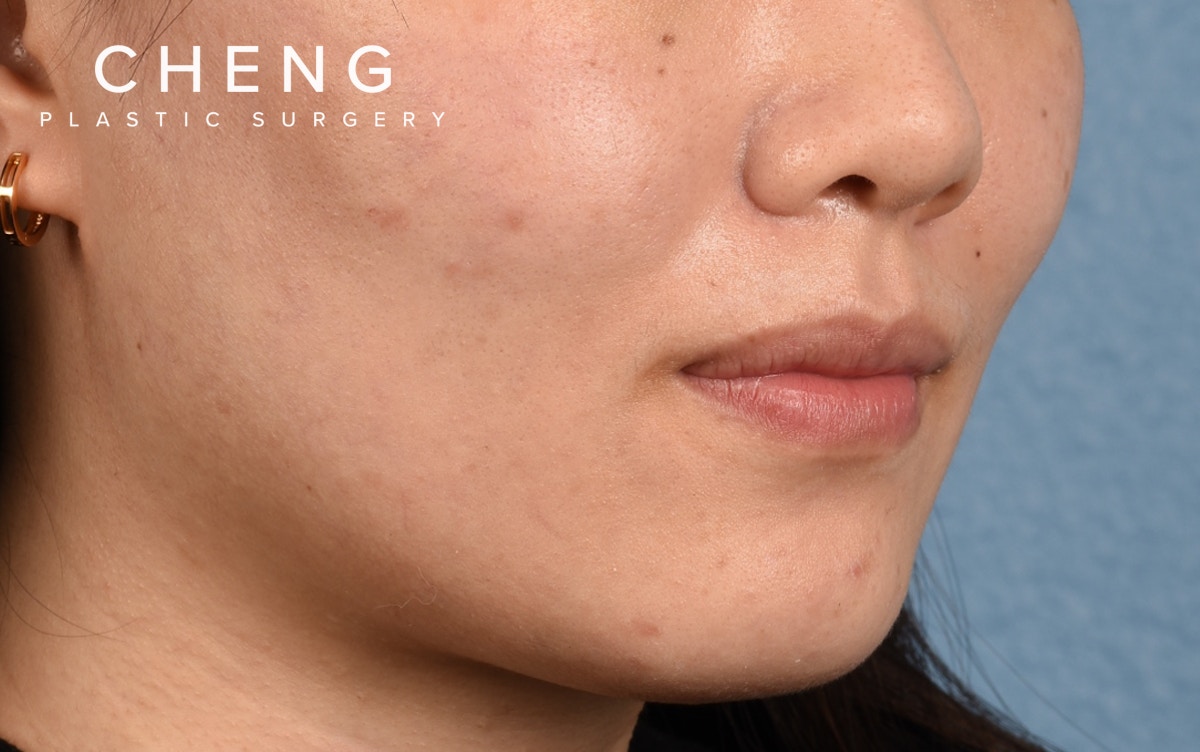 Hidden Patients Before & After Gallery - Patient 349943 - Image 3