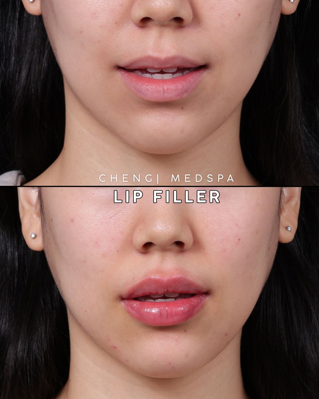 before and after