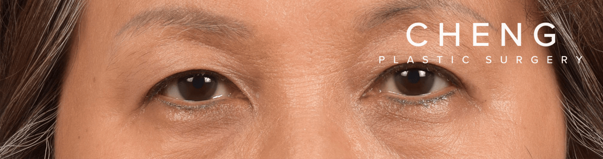 Hidden Patients Before & After Gallery - Patient 947245 - Image 2
