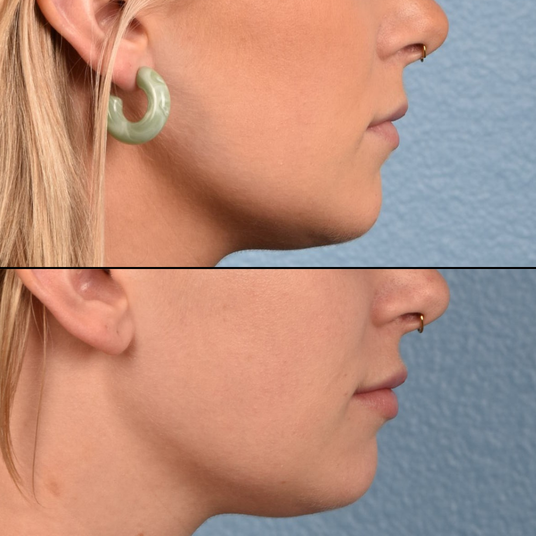 patient results