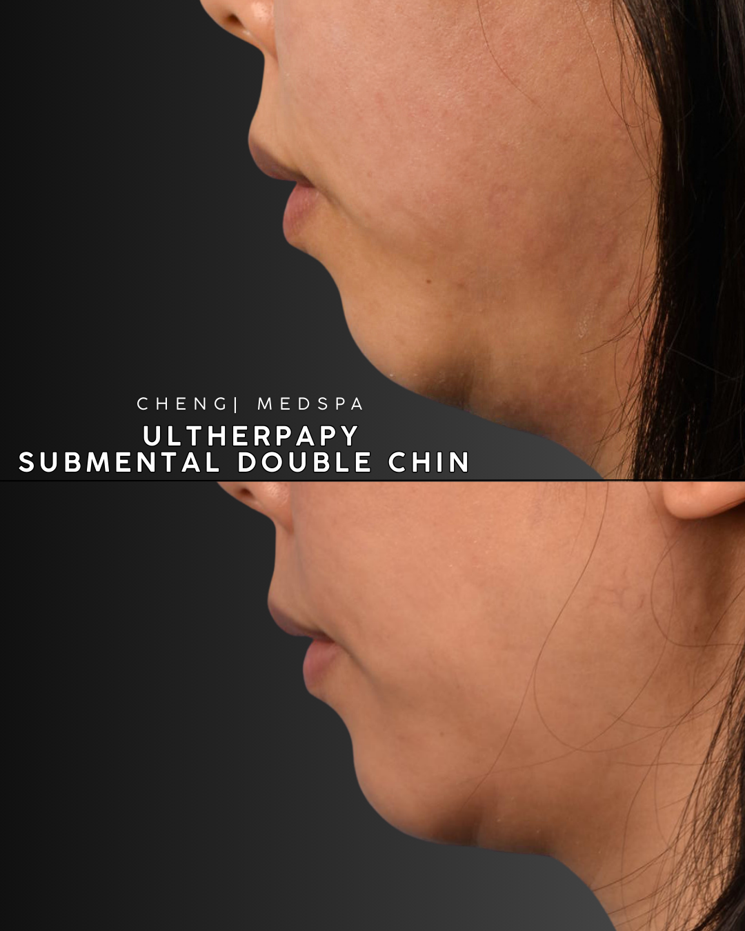 patient results