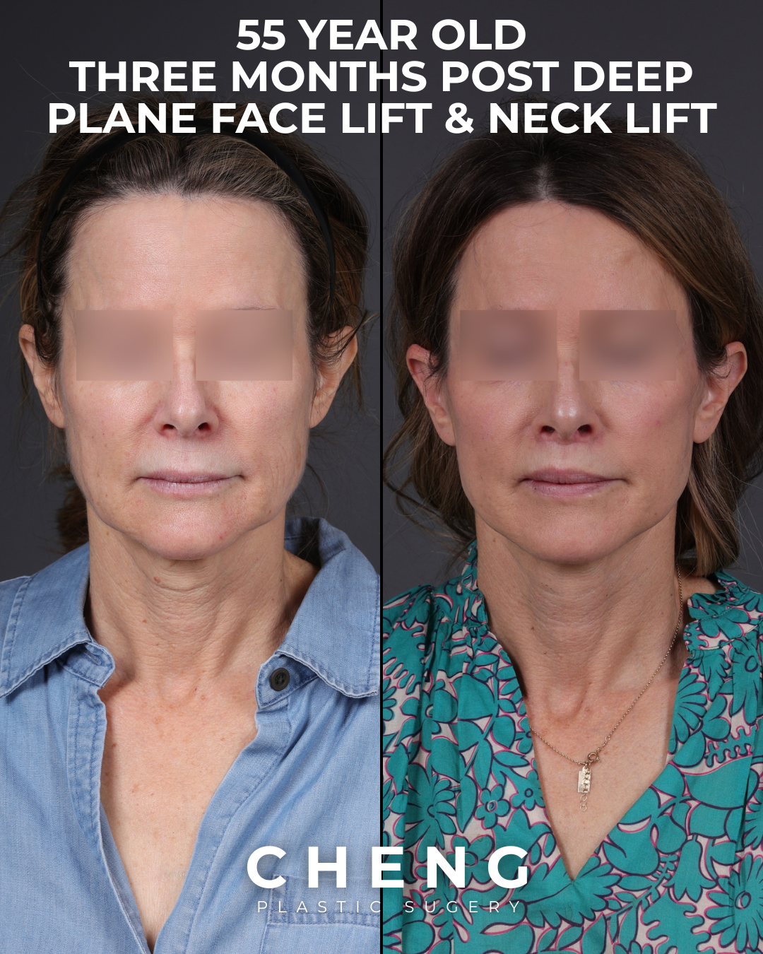 before and after