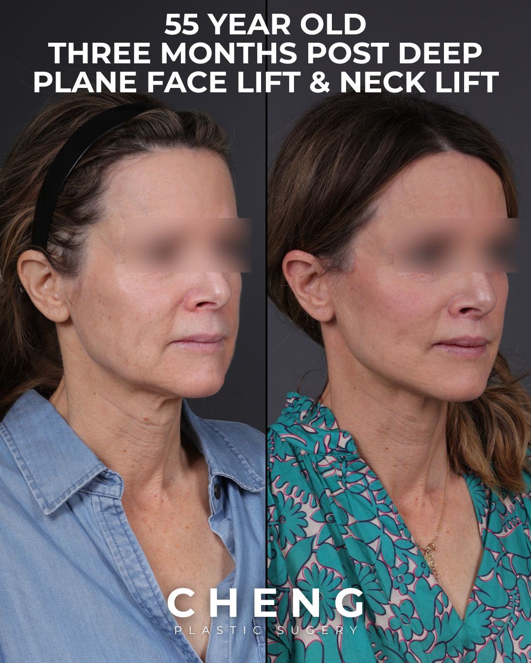 before and after