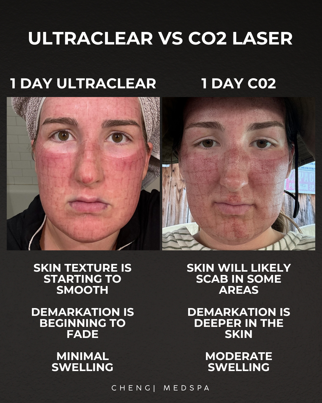 before and after