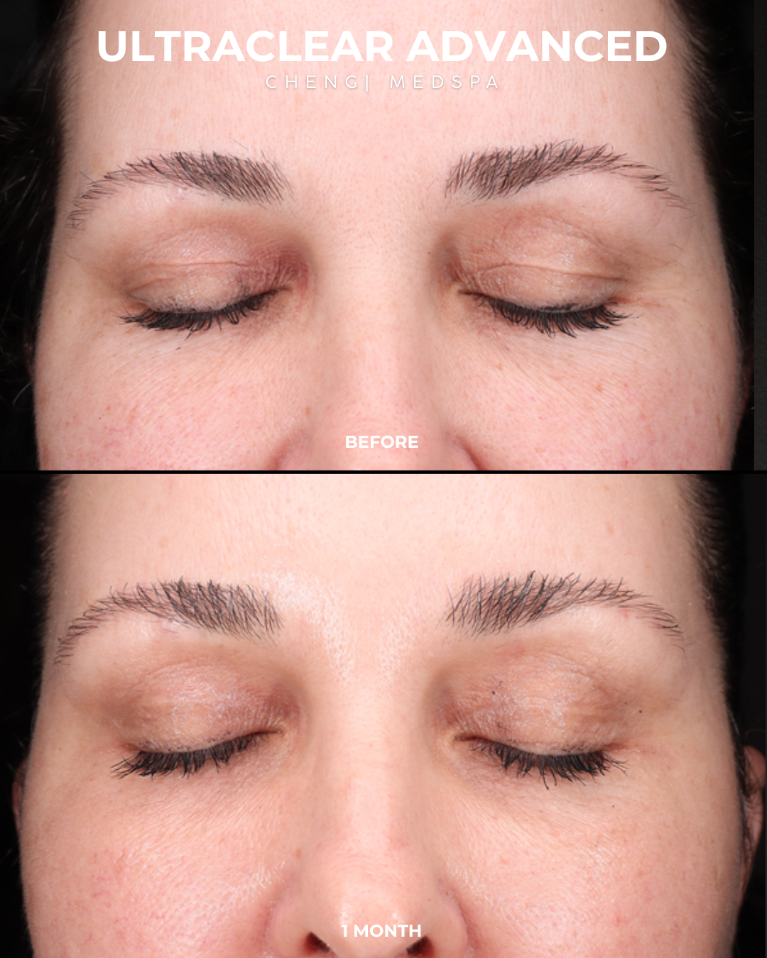 before and after