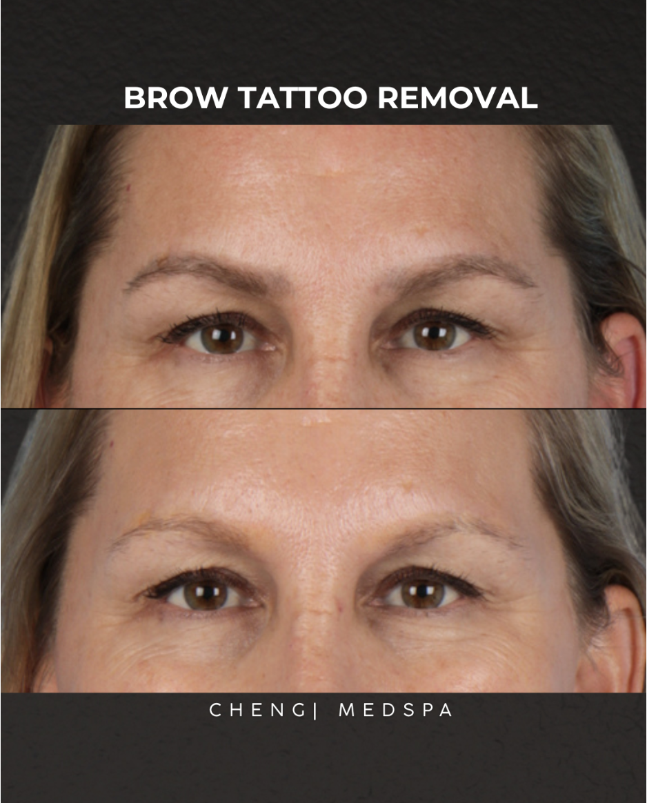 before and after