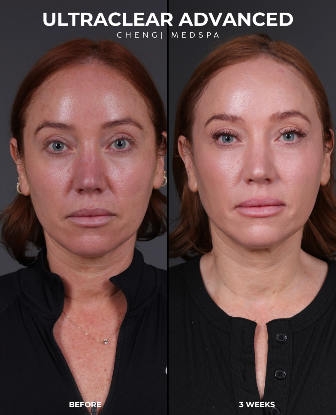 before and after